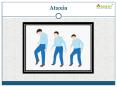 Ataxia: Types, Causes, Symptoms, Diagnosis and Treatments (1) PowerPoint PPT Presentation