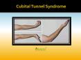 Cubital Tunnel Syndrome: Causes, Symptoms, Diagnosis and Treatment (1) PowerPoint PPT Presentation