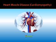 Heart Muscle Disease (Cardiomyopathy) (1)