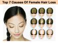 Top 7 Causes Of Female Hair Loss PowerPoint PPT Presentation