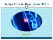 BPH (Benign Prostate Hyperplasia): Causes, Symptoms, and Treatment (1)