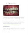 Professional Teeth Cleaning in Worthing PowerPoint PPT Presentation