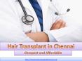 Best Hair Transplant in Chennai at Affordable Price PowerPoint PPT Presentation