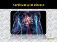 Cardiovascular Disease: Types, Causes, Symptoms, Diagnosis and Treatment (1) PowerPoint PPT Presentation