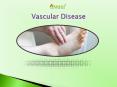 Vascular Disease: Types, Symptoms, Risks, Diagnosis, and Treatment (1) PowerPoint PPT Presentation