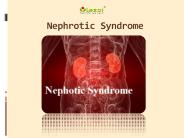 Nephrotic Syndrome: Causes, Symptoms and Treatment (1)