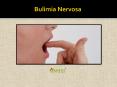Bulimia Nervosa- Symptoms, Causes and Treatment (1) PowerPoint PPT Presentation