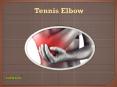 Tennis Elbow: Information on causes, symptoms, diagnosis and treatment (1) PowerPoint PPT Presentation