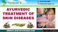 Ayurvedic Treatment of Skin Diseases - Types, Causes, Symptoms