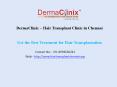 Get the Best Treatment for Hair Transplantation PowerPoint PPT Presentation