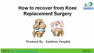How to recover from Knee replacement surgery?