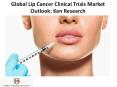 Global Lip Cancer Clinical Trials Market Outlook: Ken Research PowerPoint PPT Presentation