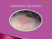 Seborrheic Dermatitis: Symptoms, causes and treatment (1)