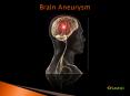 Brain Aneurysm: Causes, symptoms, diagnosis and treatment (1) PowerPoint PPT Presentation