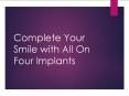 Complete Your Smile with All On Four Implants PowerPoint PPT Presentation
