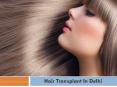 Hair Transplant in Delhi PowerPoint PPT Presentation