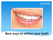 Best ways to whiten your teeth