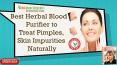 Best Herbal Blood Purifier to Treat Pimples, Skin Impurities Naturally