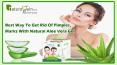 Best Way to Get Rid of Pimples, Marks with Natural Aloe Vera Gel PowerPoint PPT Presentation