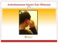 Autoimmune Inner Ear Disease: Symptoms, treatment and prevention (1) PowerPoint PPT Presentation