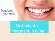 Orthodontic Treatment in Pune- Devs Oral Care