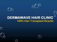 Hair Transplant Treatment in Panipat PowerPoint PPT Presentation