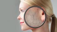 Treat your dry skin with knowledge
