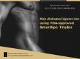 Male Abdominal Liposuction Using FDA-approved Smartlipo Triplex PowerPoint PPT Presentation