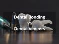 Difference Between Dental Bonding and Dental Veneers PowerPoint PPT Presentation