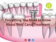 All You Need to Know About Root Canal Treatment in Burlington PowerPoint PPT Presentation