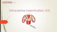 Intrauterine insemination (IUI)