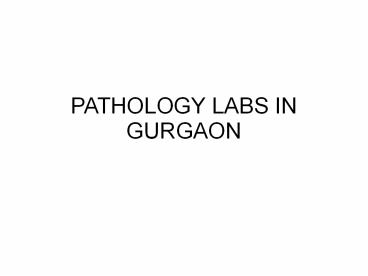 Uric Acid Test in Gurgaon
