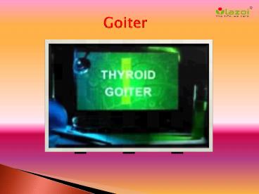 Goiter: Read about symptoms, causes and treatment (1)