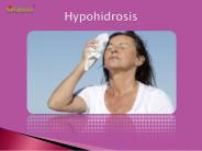 Hypohidrosis: Symptoms, Causes, Diagnosis and Treatment (1)