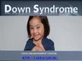 Centre for Down Syndrome (1) PowerPoint PPT Presentation