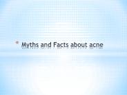 Myths and Facts about acne