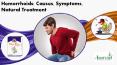 Hemorrhoids: Causes, Symptoms, Natural Treatment PowerPoint PPT Presentation