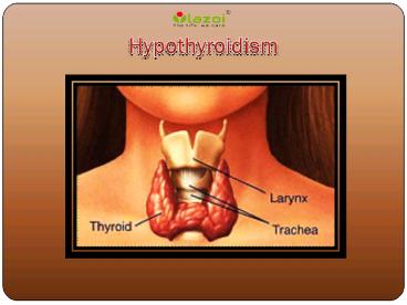 Hypothyroidism (Under-active Thyroid): Symptoms, causes and treatment