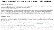 Hair Transplant Price