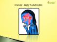 Kluver-Bucy Syndrome: Very rare behavioural disorder (1) PowerPoint PPT Presentation