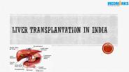 Liver transplantation in India - MedMonks
