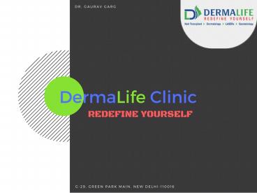 Best Hair Transplant Center in South Delhi|Hair Transplant Clinic in Delhi