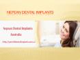 Dental Implants Dentistry | All-On-4 Implants Sydney PowerPoint PPT Presentation