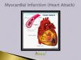 Myocardial Infarction (Heart Attack): Symptoms, Causes, Risk Factors, Diagnosis, and Treatment (1) PowerPoint PPT Presentation