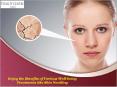Remove Skin Blemishes with IPL Laser Treatment PowerPoint PPT Presentation