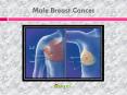 Male Breast Cancer: A rising concern among men (1) PowerPoint PPT Presentation