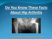 Do You Know These Facts About Hip Arthritis