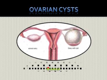 Ovarian Cysts: Common Uterine Conditions (1)