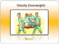 Obesity (Overweight): Symptoms, Causes and treatment (1) PowerPoint PPT Presentation