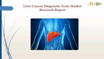 Liver Cancer Diagnostic Tests Market Research Report